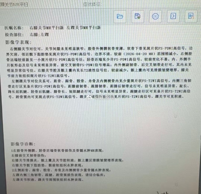 右膝前交叉韧带损伤 高诗岩赴美康复